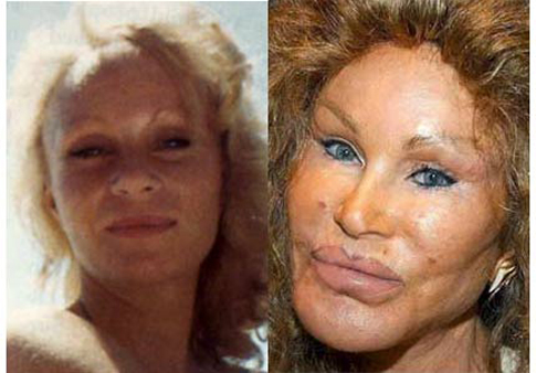 Jocelyn Wildenstein avant/ après la chirurgie esthétique