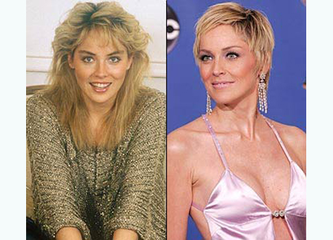 sharon stone avant/après la chirurgie esthétique