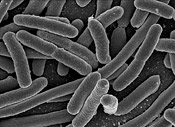 Escherichia coli ou colibacille