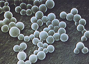 Staphylococcus aureus ou staphylocoque doré